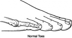 Normal Toe